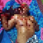 Korban pembacokan oleh salah seorang pelaku di Asmat – Surya Papua/IST