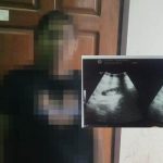 Korban GN bersama hasil dari salah seorang dokter setelah dinyatakan hamil – Surya Papua/Frans Kobun