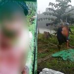 Korban yang mengalami luka bacok akibat penganiayan – Surya Papua/IST