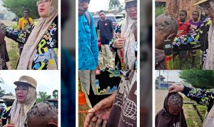 Wakil Bupati Merauke, Fauzun Nihayah sedang memeriksa luka di sekujur tubuh salah seorang anak Papua – Surya Papua/IST