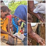 Wakil Bupati Merauke, Fauzun Nihayah sedang membersihkan luka-luka seorang anak – Surya Papua/IST